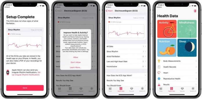 Apple: ECG App In Apple Watch May Start Service In Brazil And Japan Next